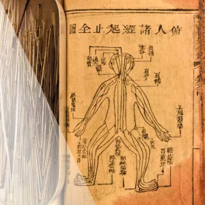Chinese & Japanese Acupuncture: Two Traditions, One Lineage