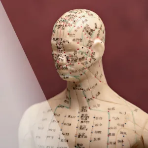 The Healing Landscape of Scalp Acupuncture