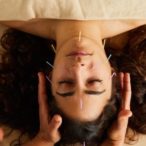 High angle of a woman lying on a table in an alternative medicine spa having an acupuncture and reiki treatment done on her face by an acupucturist